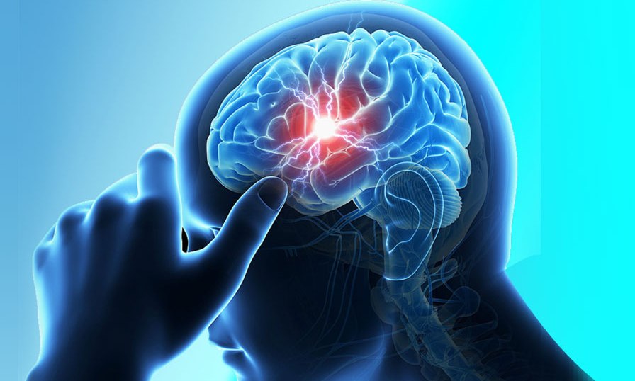 नेपालमा हरेक १० मिनेटमा १ जनालाई मस्तिष्कघात